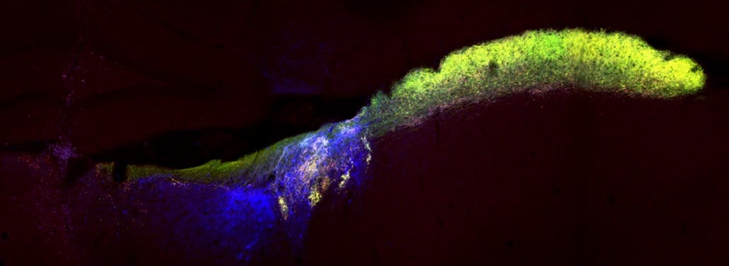 Journal Club Postsynaptic Neuronal Activity Promotes Retinal Axon