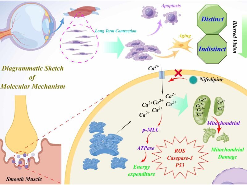 Pilocarpine mediated excessive calcium accumulation leads to ciliary ...